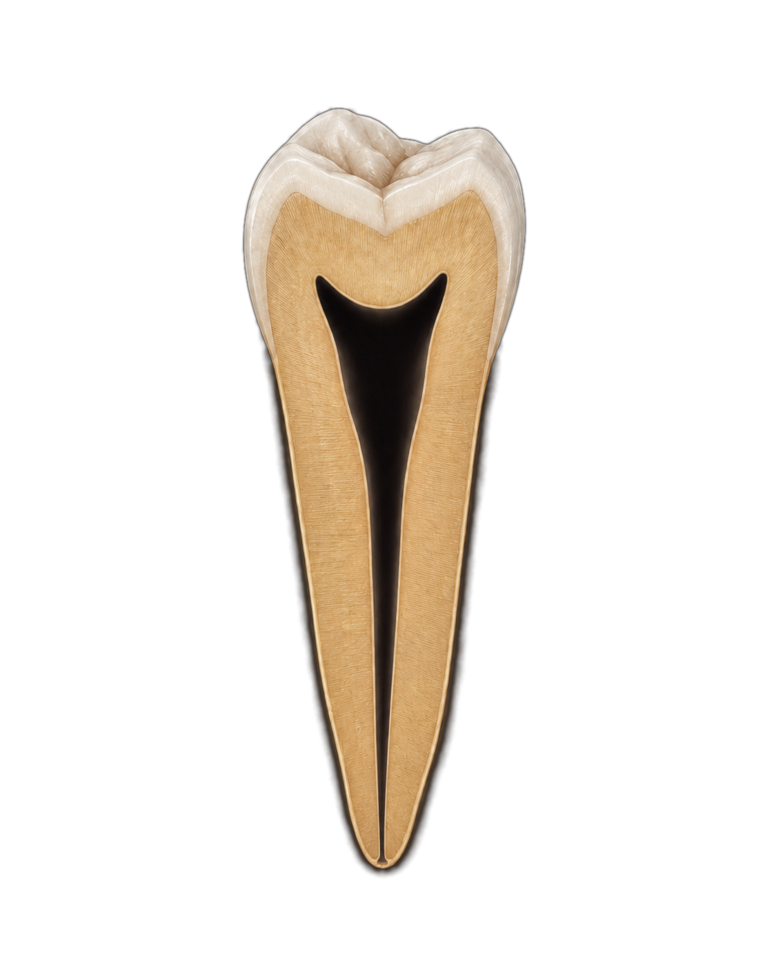 Cleaned, empty root canal