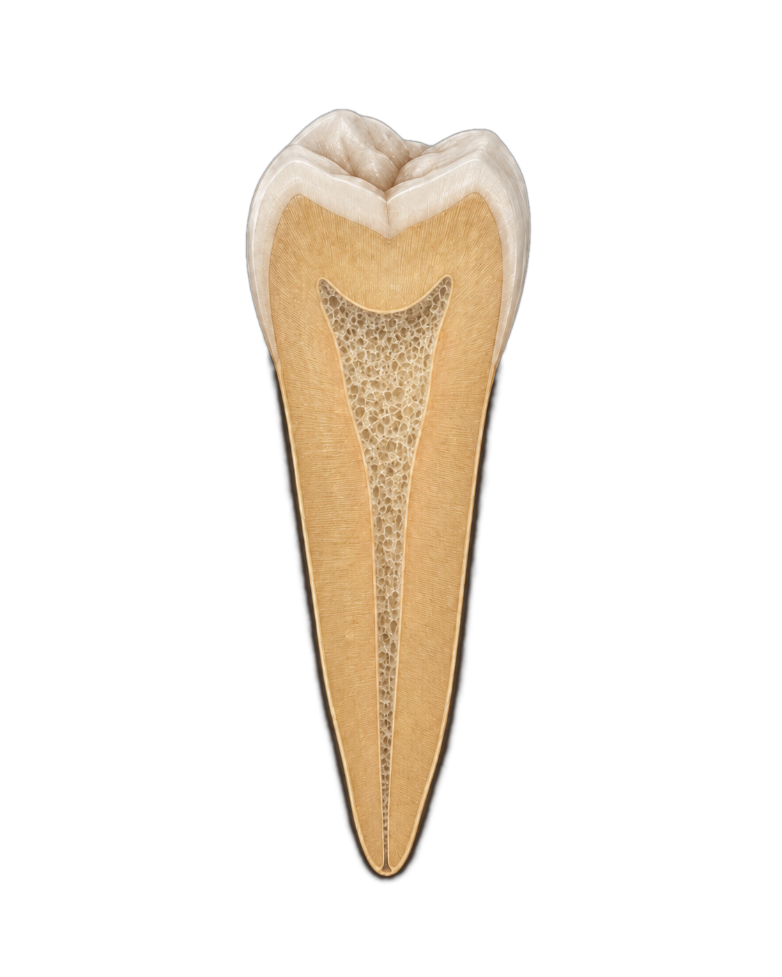 Root canal filled with an injectable scaffold