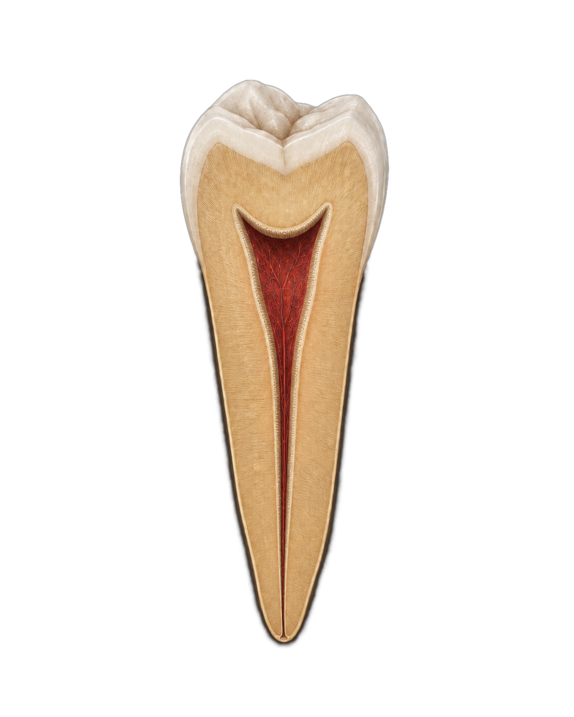 Regenerated canal with new tubular dentin